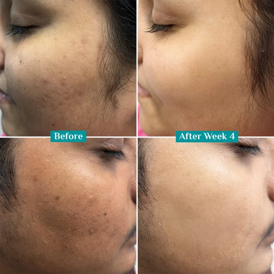 Vitamin C Face Serum