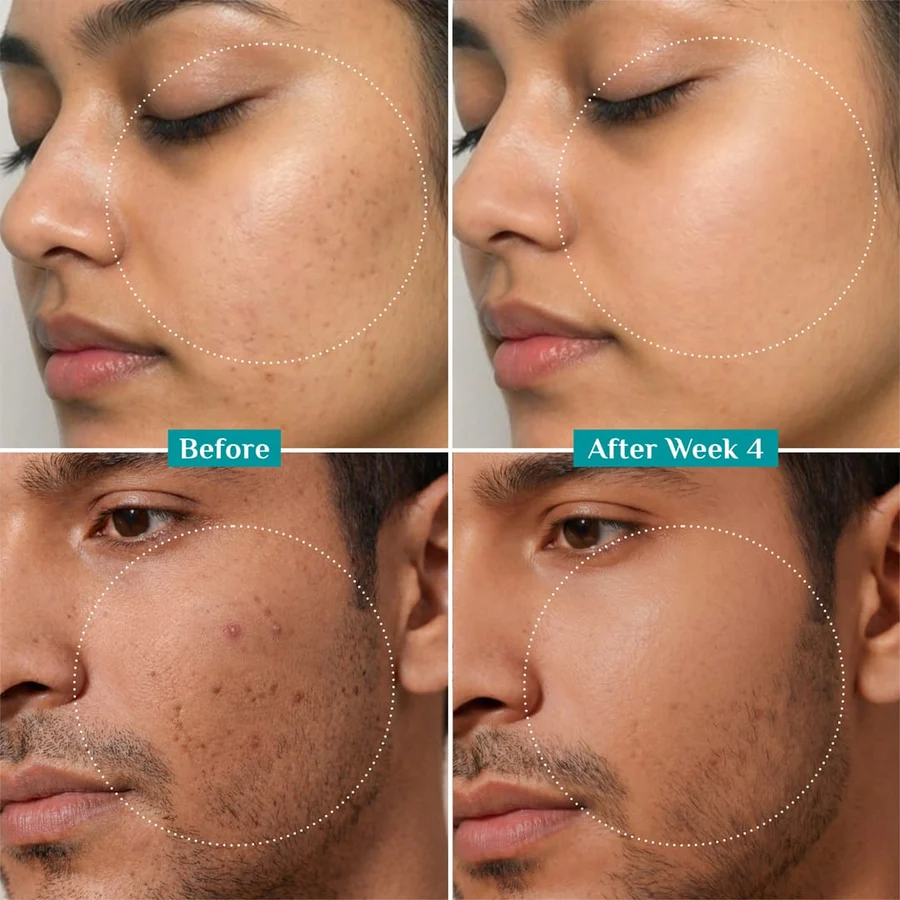 Niacinamide Face Serum With Kojic Acid & Korean Rice Water