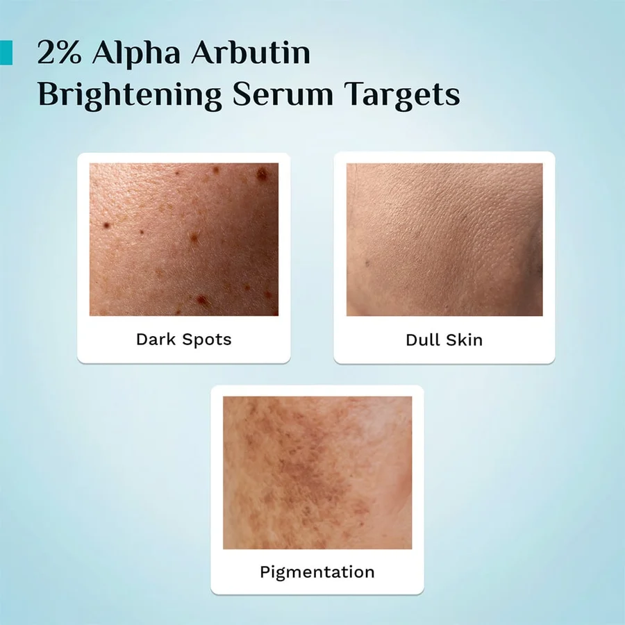 Alpha Arbutin Brightening Serum