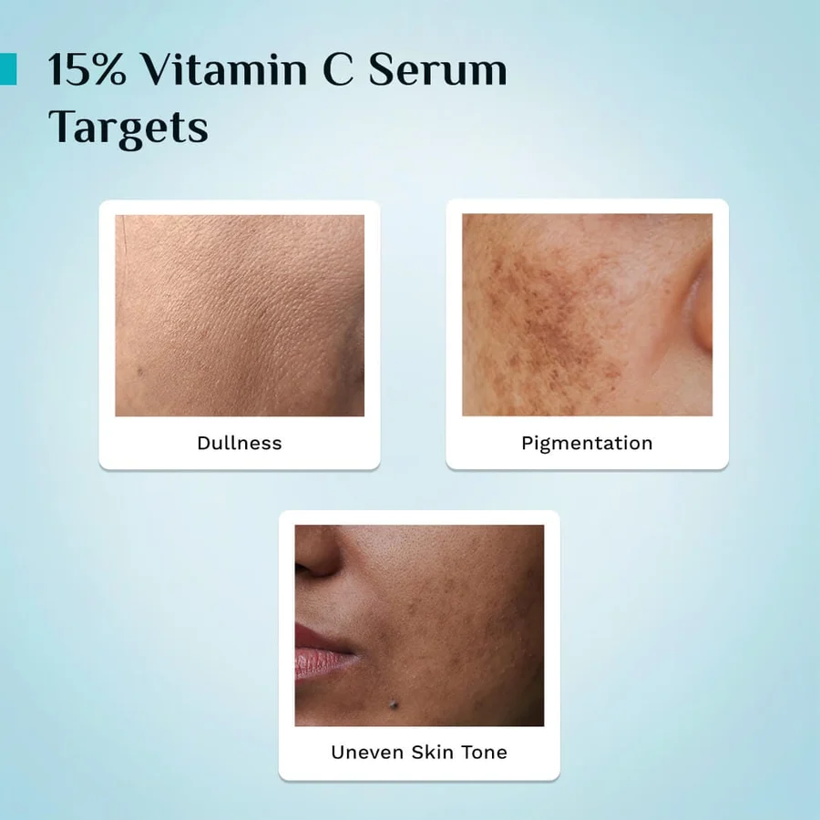 15% Vitamin C Face Serum For Advanced Brightness