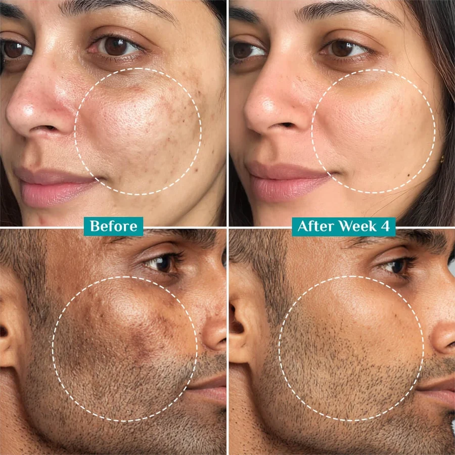 15% Vitamin C Face Serum For Advanced Brightness